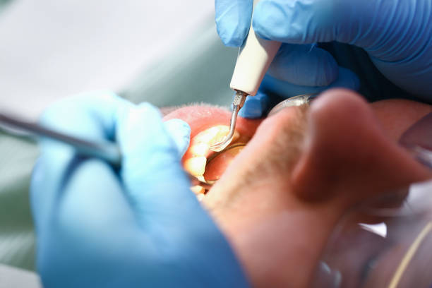 Emergency Dentist Open Today in SC